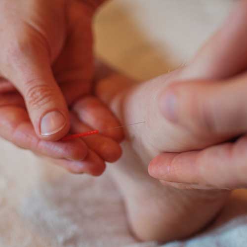 Acupuncture Services in Bend, Oregon Green Willow Acupuncture